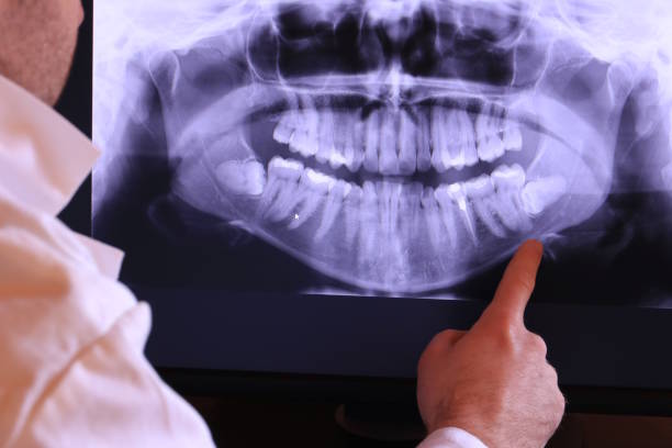 Best Emergency Gum Treatment in Nowata, OK