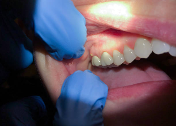 Best Emergency Dental Care for Broken or Chipped Teeth in Nowata, OK